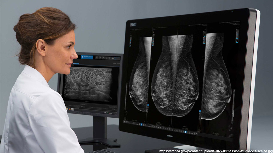 Искусственный интеллект будет анализировать маммографию владимирских пациенток