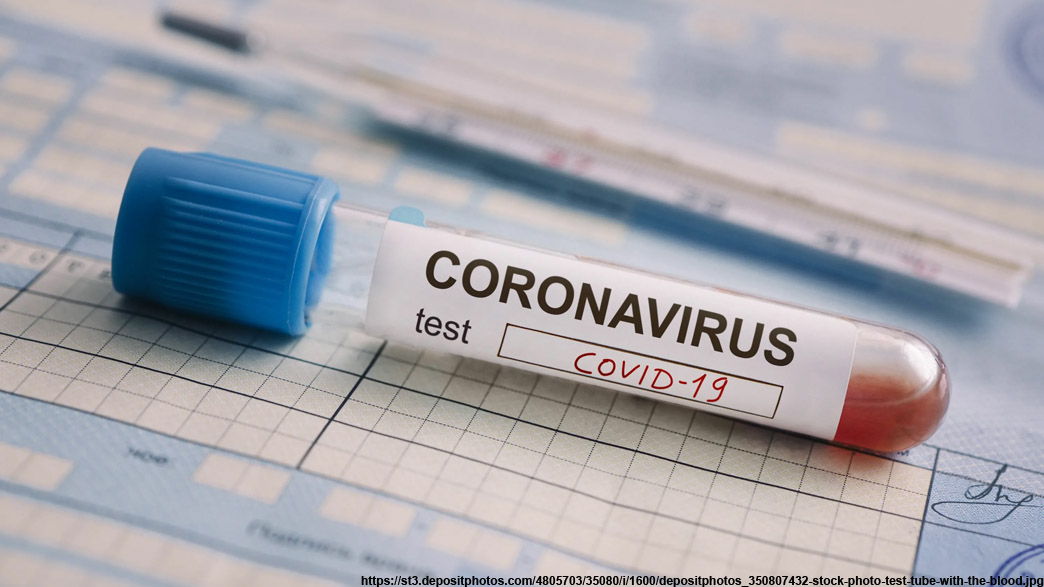 За сутки во Владимирской области прибавилось 22 новых случая коронавирусной инфекции