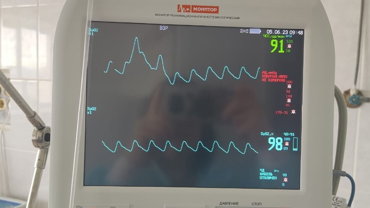Владимирские больницы получили новое оборудование еще на 94 миллиона рублей