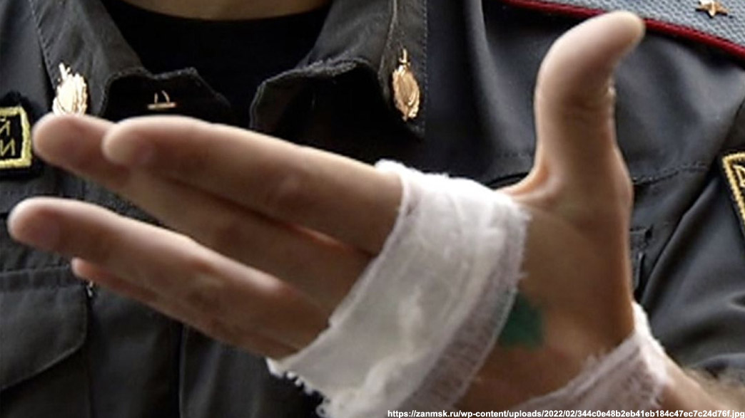Укус владимирского полицейского за руку оценили в 20 тысяч рублей