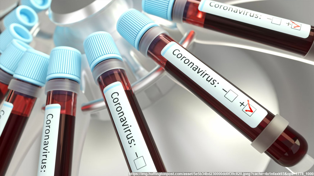 Официальный бюллетень по коронавирусу на 9 июля - во Владимирской области подтверждено 3 новых смерти от COVID-19