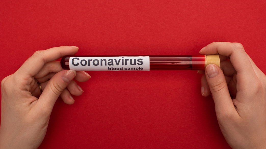 Резкий рост: 172 заболевших коронавирусом и 6 умерших от ковида установлены за сутки во Владимирской области
