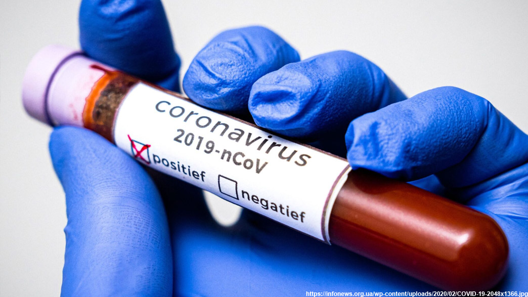 Официальный бюллетень по коронавирусу на 20 июля — во Владимирской области осталось 608 человек в активной фазе заболевания COVID-19