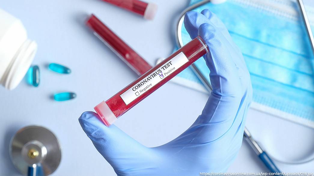 За сутки во Владимирской области коронавирус диагностировали у 54 человек. Это на два человека больше, чем сутки назад