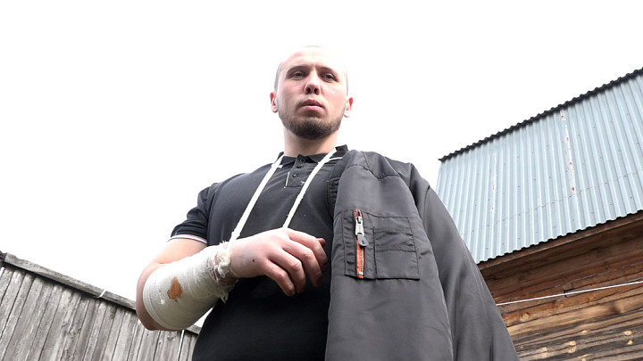 Пострадавший от нападения алабая житель Мурома добился взыскания морального вреда с владельца собаки