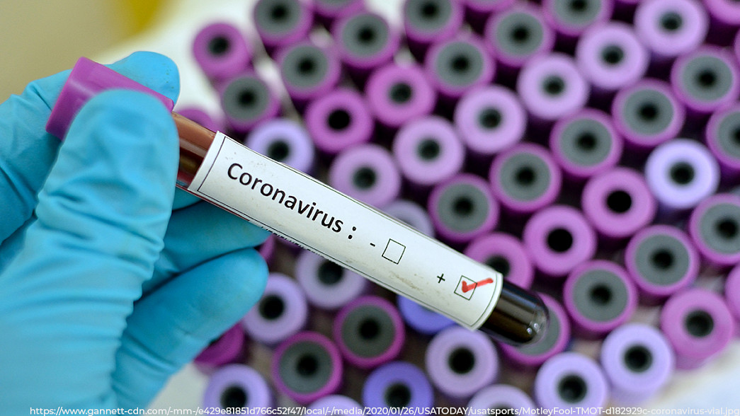2181 заболевший коронавирусом владимирец. За неделю количество зараженных выросло более, чем на 800 человек