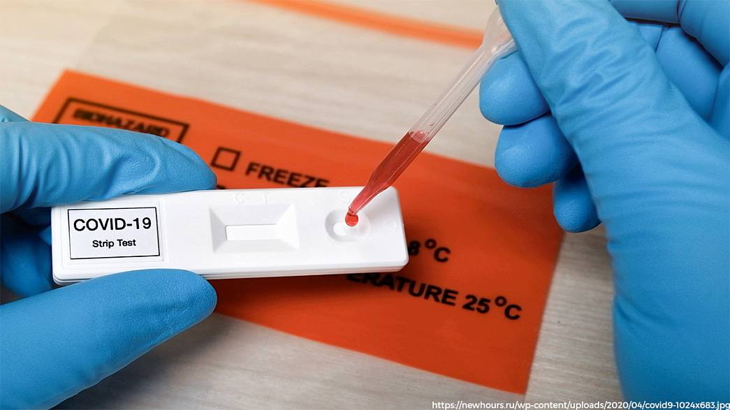 Жители города Владимира смогут сделать бесплатные тесты на антитела к коронавирусу. Время тестирования и количество анализов — ограничены