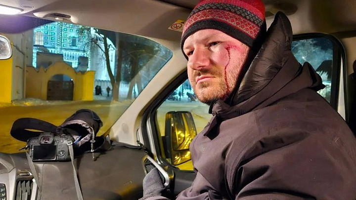 Делу о наезде конной повозки на журналиста придали уголовный статус